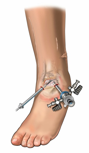 ankle scope photo